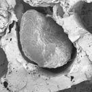 Electron microscopy of fat organoids that were implanted to out-compete tumors. Image by Ahituv Lab