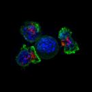 Killer T-Cells