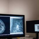 Image of Mammogram. Photo by Erin Lubin