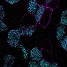 Centrioles (cyan) in lung cells. Cell boundaries are in magenta. Credit: Semil Choksi