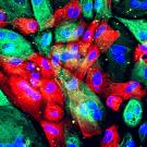 Human prostate cells from an organoid, an artificial construct that resembles an organ. Image by National Cancer Institute, NIH