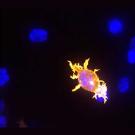 A fluorescent microscope image shows a glowing orange T cell with long, spiky extensions latching onto a purple-toned cancer cell. The interaction occurs against a dark background featuring several blurry blue orbs.