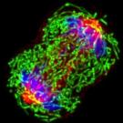 A triple-negative breast cancer cell in metaphase during cell division. Image by National Cancer Institute