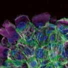 Organoid image by Kutys Lab, UCSF